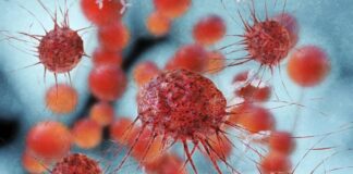 Crean un reloj epigenético que predice la evolución de pacientes con cáncer