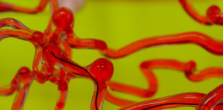 Nuevo robot para tratar de forma remota los accidentes cerebrovasculares