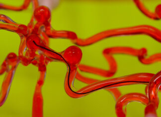 Nuevo robot para tratar de forma remota los accidentes cerebrovasculares