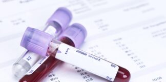 Un análisis de sangre podría detectar cáncer antes de que aparezcan síntomas