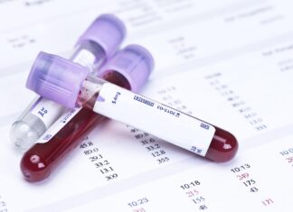 Un análisis de sangre podría detectar cáncer antes de que aparezcan síntomas