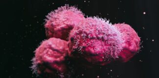 ¿Aceleran los hongos el crecimiento de los tumores?