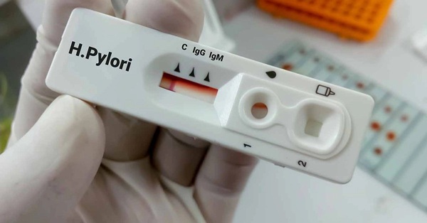 Cáncer gástrico La erradicación del Helicobacter pylori debe ser prioridad de salud pública, porque es una infección endémica con tasas de reinfección cercanas a 20 por ciento