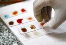 «Sangre dorada»: por qué los científicos están intentando cultivar la sangre más rara del mundo en un laboratorio Solo se conocen 50 personas en el mundo con el tipo de sangre Rh nulo