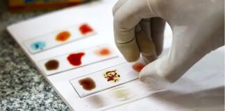 «Sangre dorada»: por qué los científicos están intentando cultivar la sangre más rara del mundo en un laboratorio Solo se conocen 50 personas en el mundo con el tipo de sangre Rh nulo