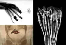 Muestra en Oaxaca revela alegorías de los rayos X Imagen de la exposición Rayos X mexicanos que explora la radiografía en el arte
