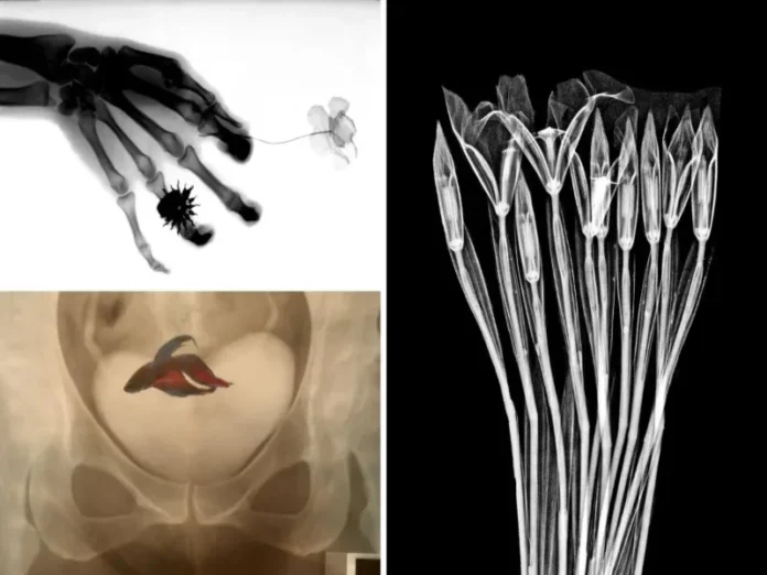 Imagen de la exposición Rayos X mexicanos que explora la radiografía en el arte