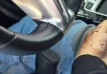 Zenyazen Escobar García (+): graves fallas en la narrativa oficial; un caso… Imagen que ilustra la muerte Zenyanzen Escobar y la polémica oficial